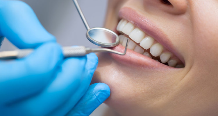 centre dentaire Lancy - Higienista dental