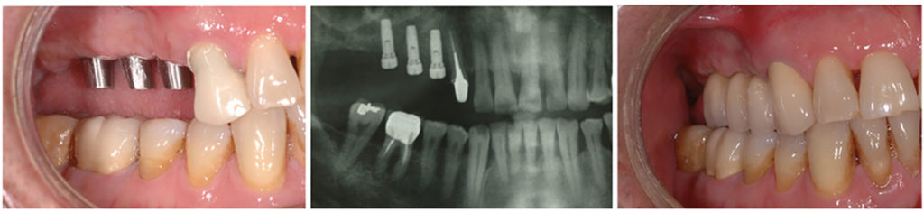 Radiologia e implantologia no centro dentário Champel