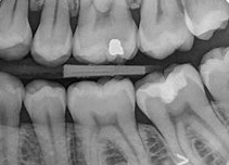 Adultos com asas dentadas