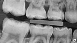 Crianças com asas dentadas